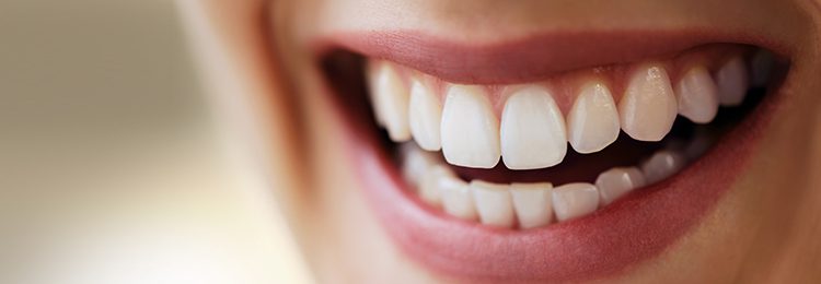 Allen Dental Center offers porcelain veneers in Allen, TX