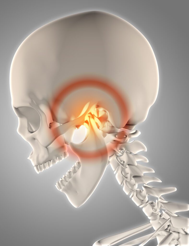 TMJ treatment in Allen, TX