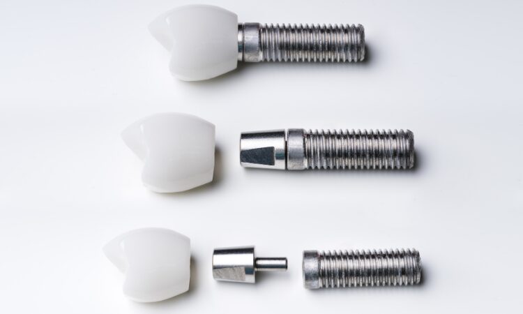Caring for Dental Implants